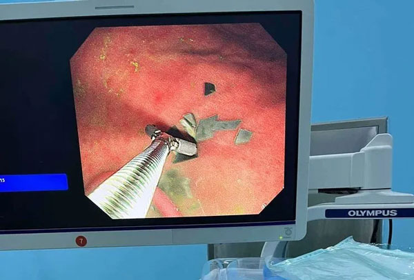 【仁心仁术】“奇葩”治疗方案，赢得家属纷纷点赞