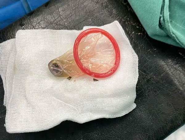 【仁心仁术】“奇葩”治疗方案，赢得家属纷纷点赞