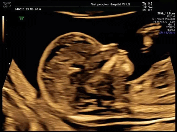 5月起,孕产妇、新生儿可在我院免费获得八项服务! 5月起,孕产妇、新生儿可在我院免费获得八项服务!